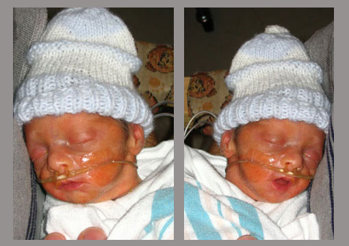 Nose Cannulas need to be taped on the face.  Eli had a bad reputation of ripping his off.  Those sweet knit hats are made by volunteers for all the preemies.