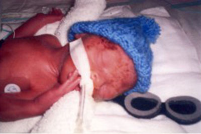 Eli's First Picture