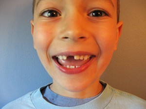 no-tooth