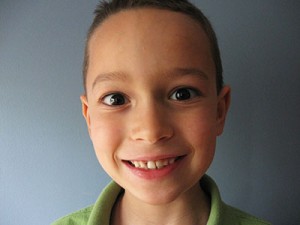 snaggle-tooth